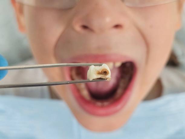 Best Emergency Treatment for Toothache in Cool Valley, MO